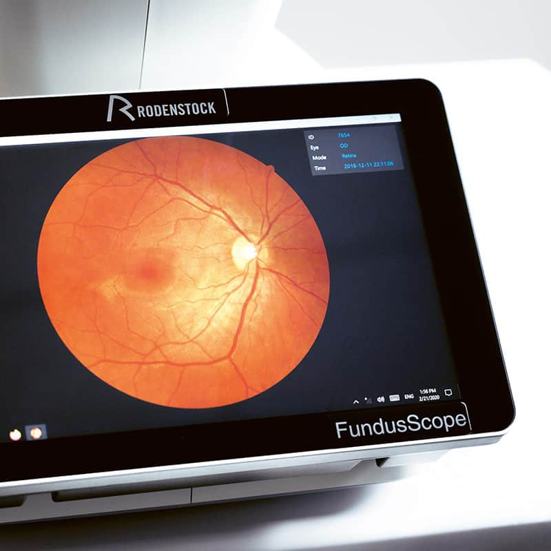 Rodenstock Fundus